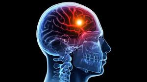 world stroke day every second is crucial when stroke hits a person