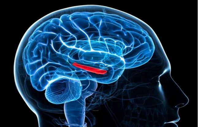 World Stroke Day: What you should know about brain attack