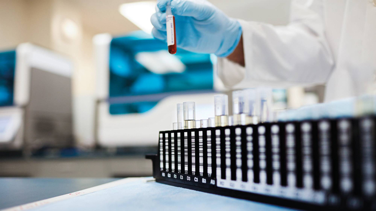 ICMR releases draft of India’s first essential diagnostics list
