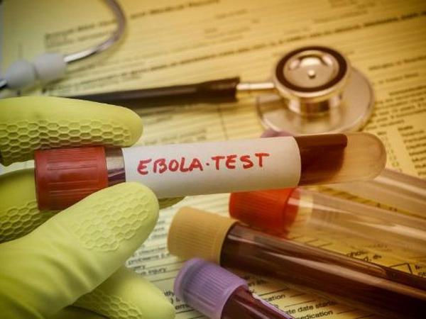 Scientists develop single-dose Ebola drug treatment