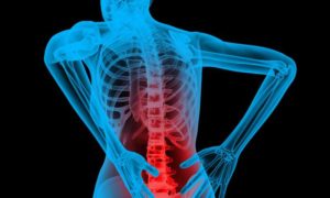 Back Pain