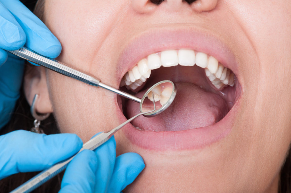 Dental hygiene: Can mouthwash backfire on you?