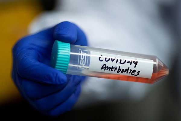 Combination of antibodies may block coronavirus infection: Study