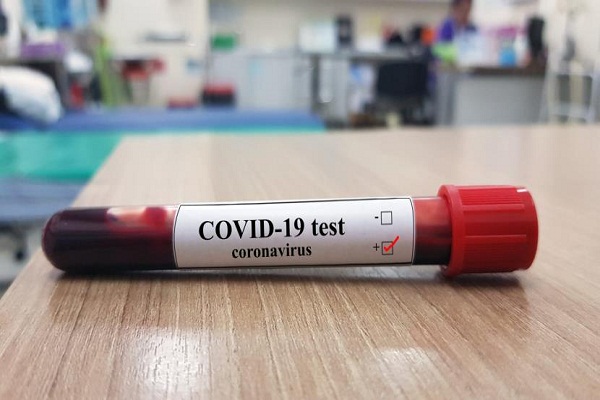 Use rapid antigen detection kit for faster Covid diagnosis: Centre to Delhi govt
