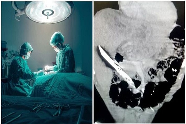 AIIMS doctors perform rare surgery, remove 20-cm knife from man’s liver