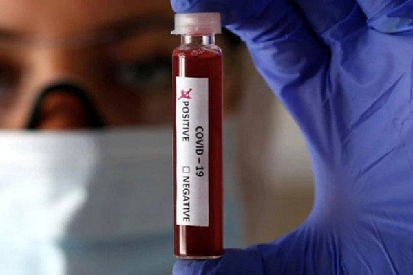 Cipla launches “Covi-G” for COVID-19 rapid antibody detection