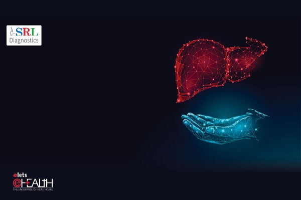 SRL Diagnostics launches Fatty Liver Index