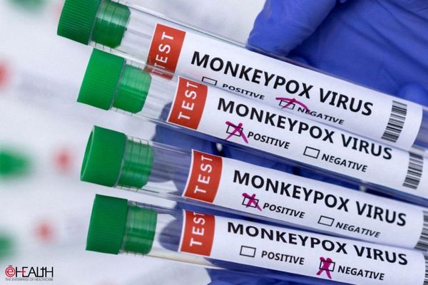 More than 50,000 Monkeypox cases recorded: WHO
