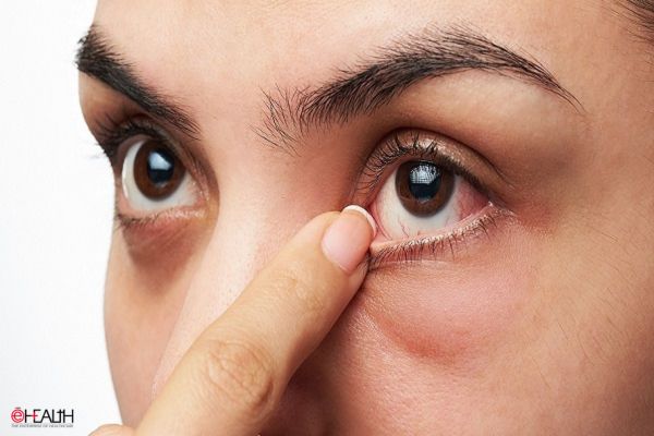 ENTOD Pharmaceuticals launches World’s first Dry Eye Therapy CYCLOTEARS® Eye Drops